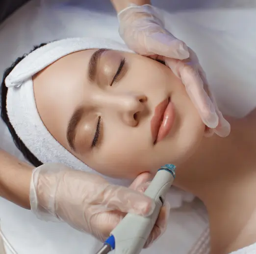 Diamond-tip microdermabrasion on a client's cheek during a facial in Málaga