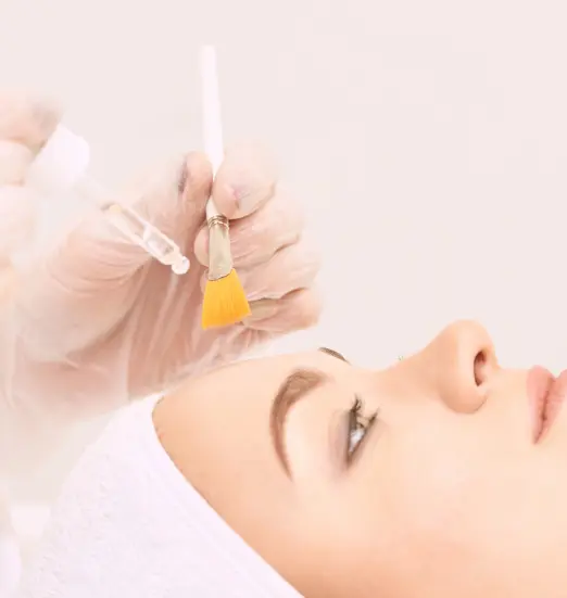 Chemical peel being applied with a brush to a client's face at our Málaga salon